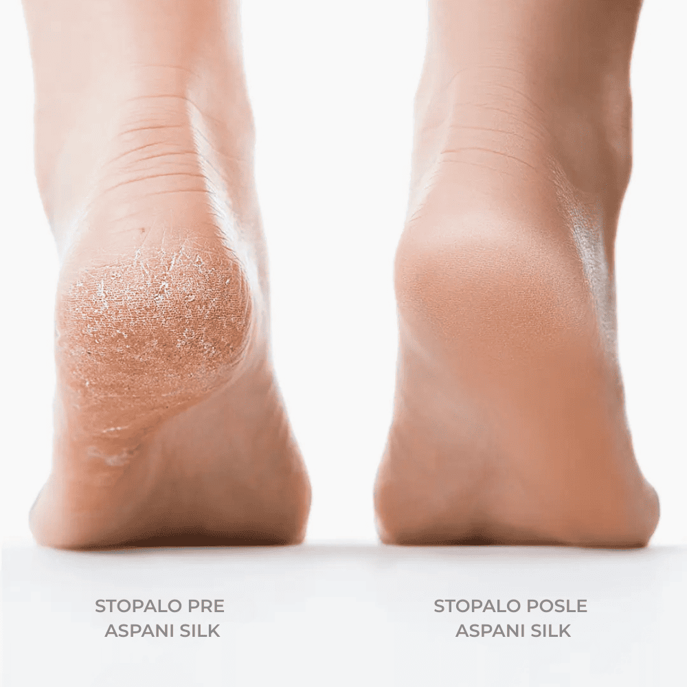 Aspani™ Silk – Za savršeno glatka stopala